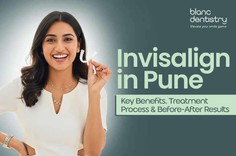 Invisalign in Pune