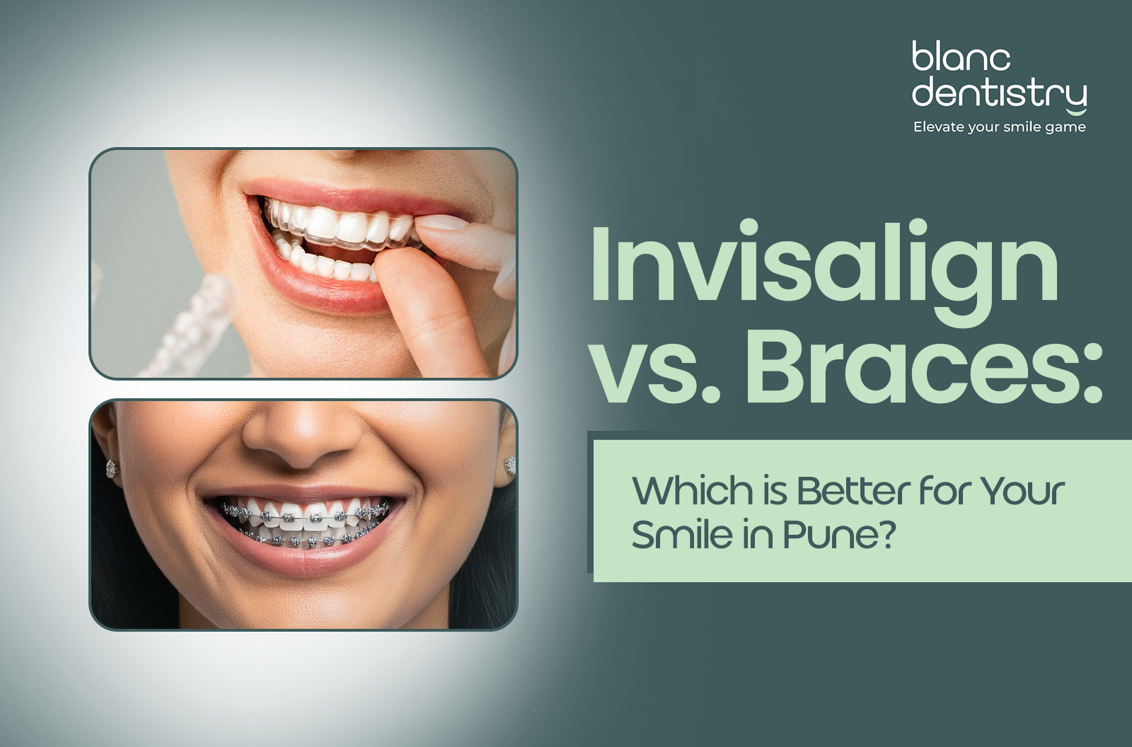 Invisalign treatment in Pune
