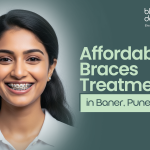 Braces Treatment in Baner