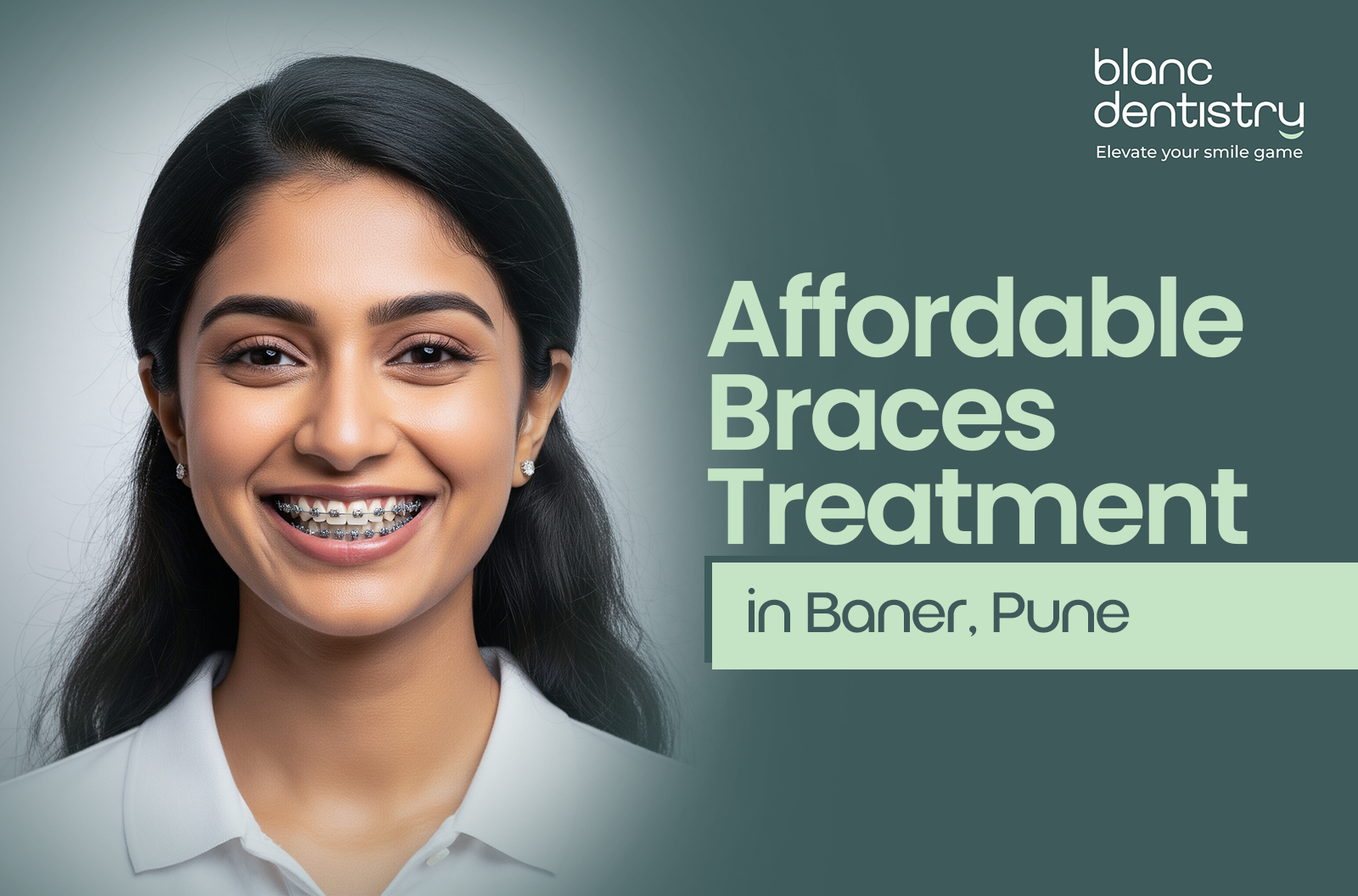 Braces Treatment in Baner