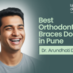 Best Orthodontic Braces Doctor in Pune