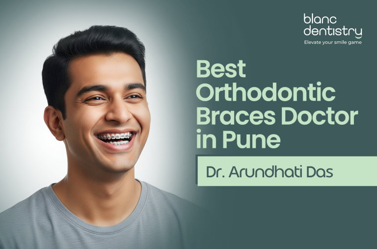 Best Orthodontic Braces Doctor in Pune
