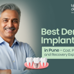Best dental implants in Pune