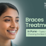 Braces Treatment in Pune