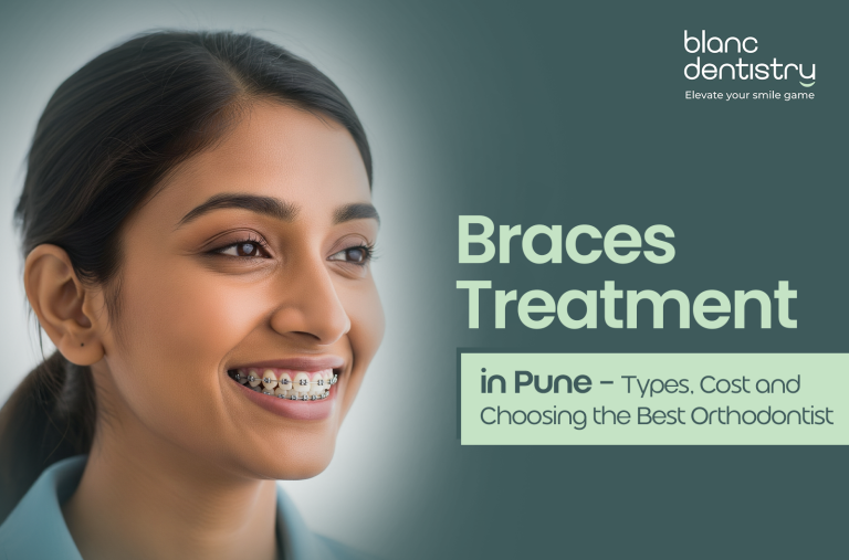 Braces Treatment in Pune