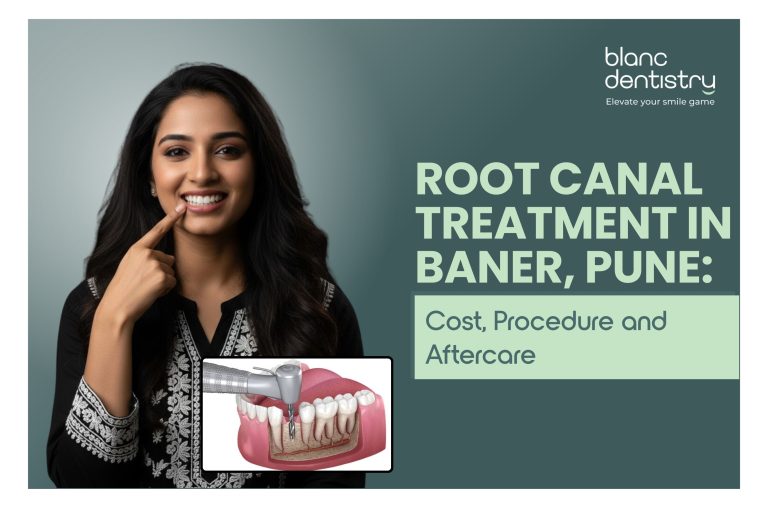 Root Canal Treatment in Baner