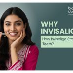 Invisalign aligners