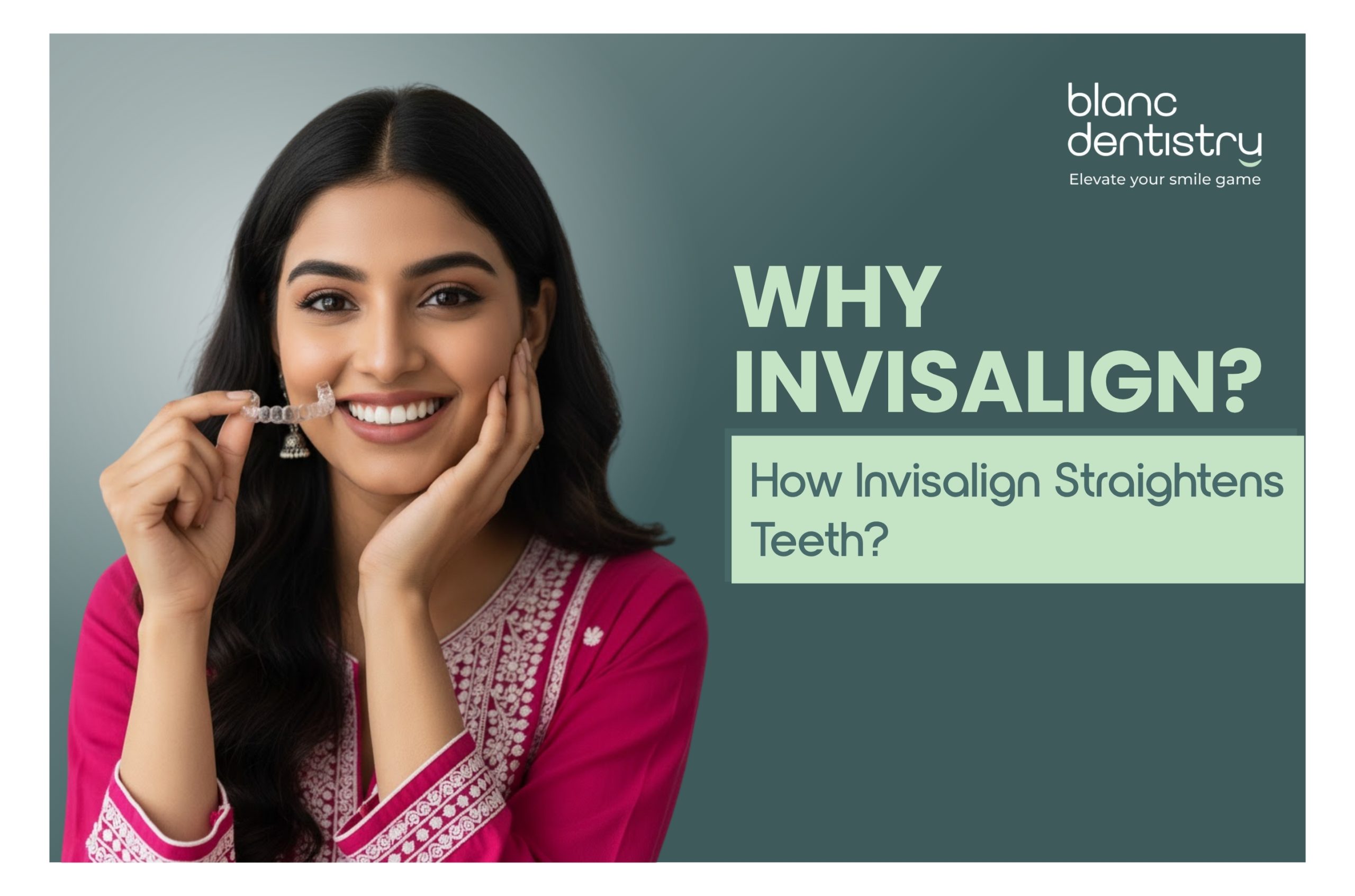 Invisalign aligners