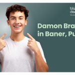 Damon Braces in Baner