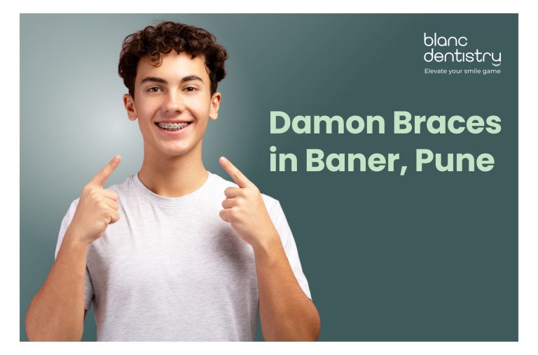 Damon Braces in Baner