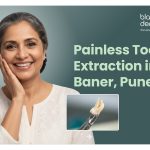Painless tooth extraction in Baner