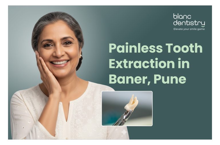 Painless tooth extraction in Baner