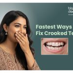 Crooked teeth