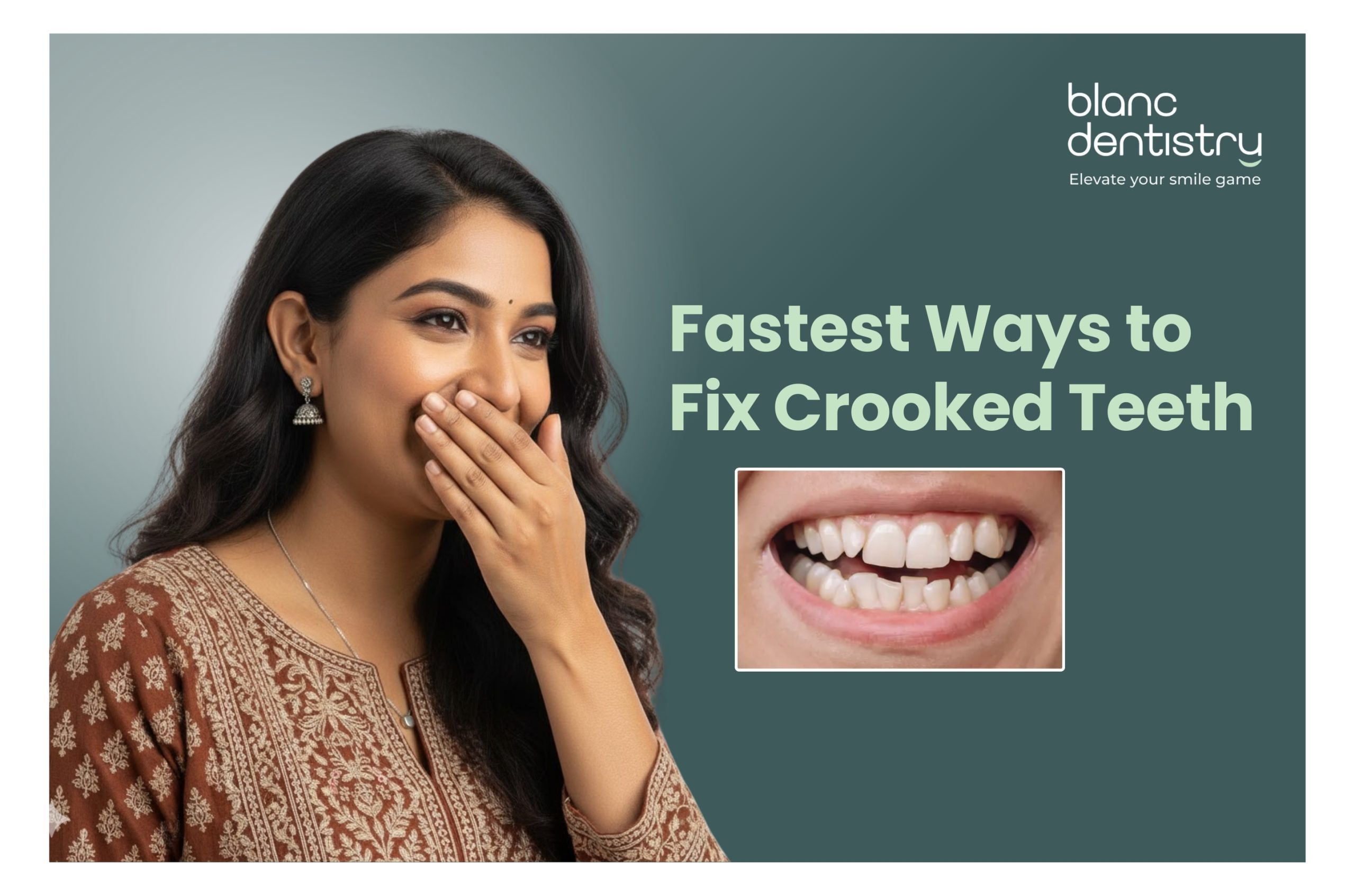Crooked teeth