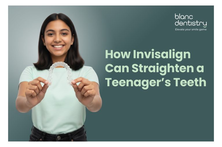 Invisalign treatment in Baner, Pune