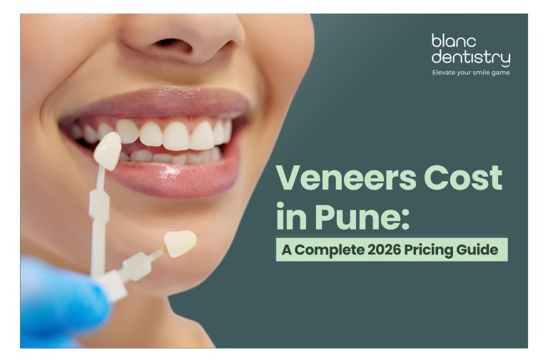 veneers cost in Pune