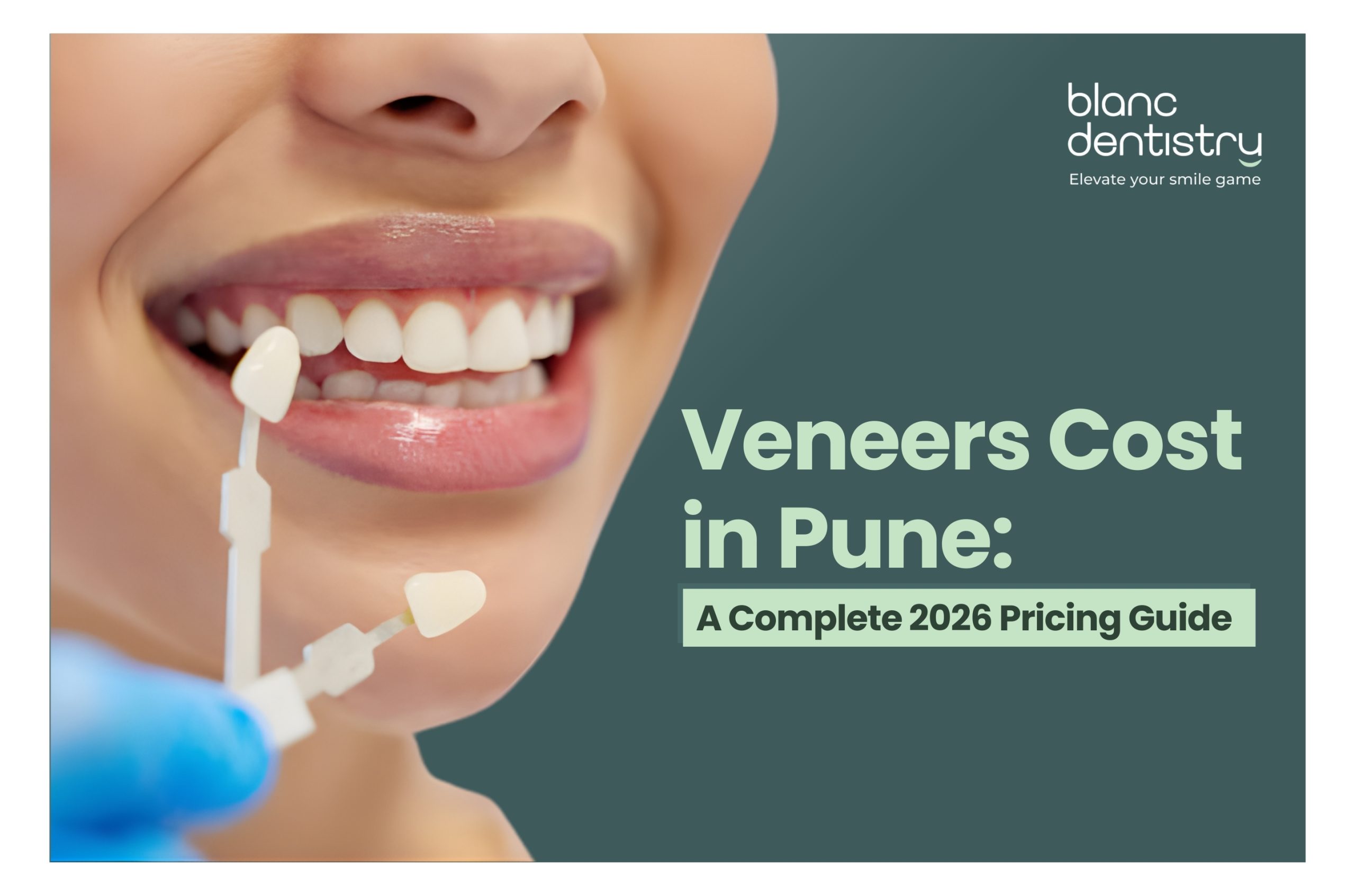 veneers cost in Pune