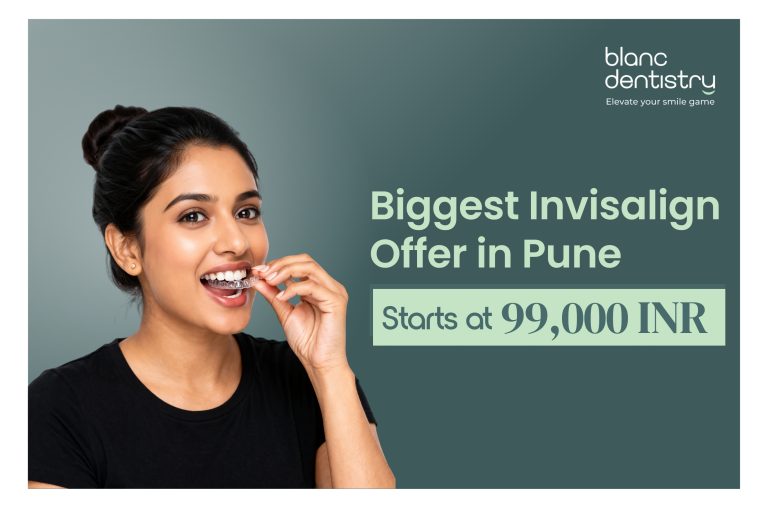 Invisalign offer in Pune starting at ₹99,000