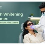 Teeth Whitening in Baner