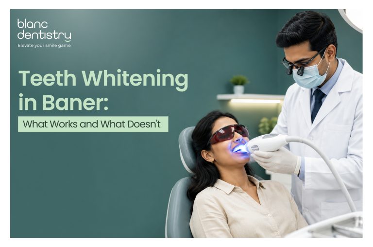 Teeth Whitening in Baner