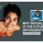 Invisalign treatment in Baner, Pune