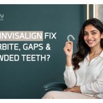 Invisalign treatment for crooked teeth