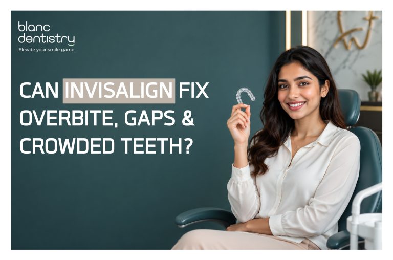 Invisalign treatment for crooked teeth